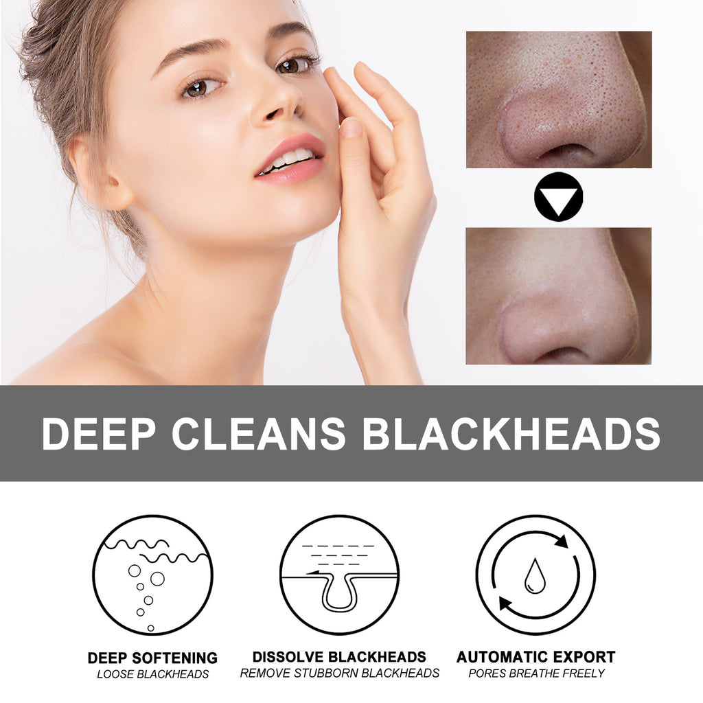 Blackhead-clearing Cream For Skin Oil Blackheads Pimples And Dead Skin Cells